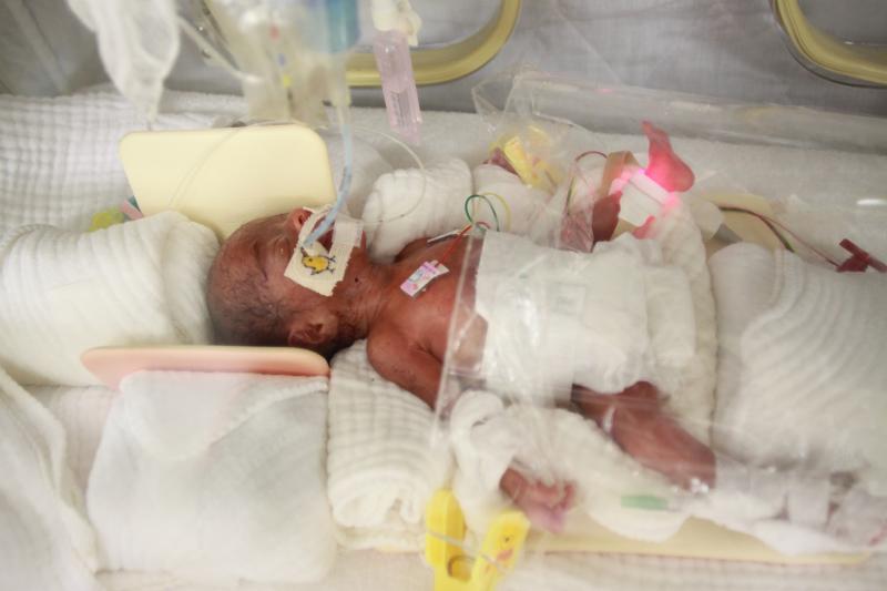 超低出生体重児 超未熟児 の大ちゃん誕生から3日以内の写真 小さな赤ちゃん応援センター